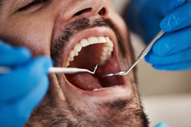 Best 24-Hour Emergency Dentist in Edinburg, IL